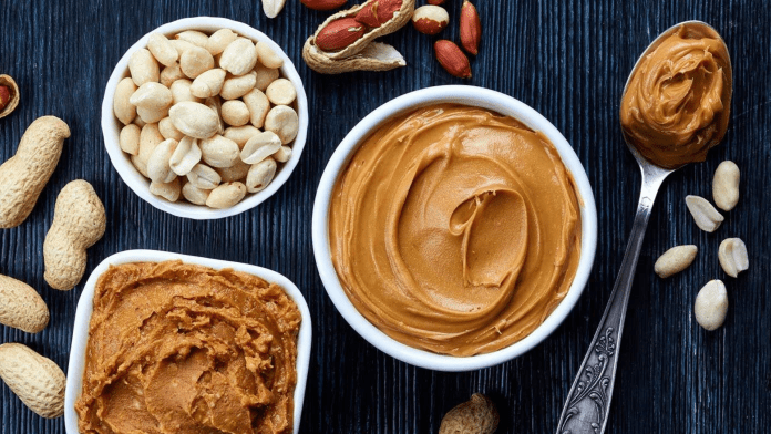 migrain food migrain food